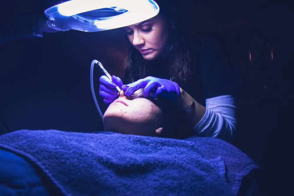 woman getting a dermabrasion (1)